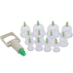 Hijama Cupping Therapy
